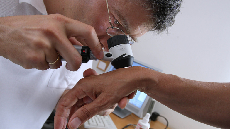Ein Hautarzt untersucht in seiner Praxis mit einem Vergrößerungsglas die Haut einer Patientin bei einer Hautkrebs-Früherkennung.