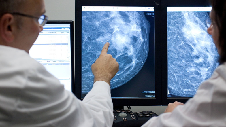 Beim Röntgen der Brust (Mammografie) erscheinen Gewebeveränderungen weiß. Das Problem: Dichtes Brustgewebe ist ebenfalls weiß.