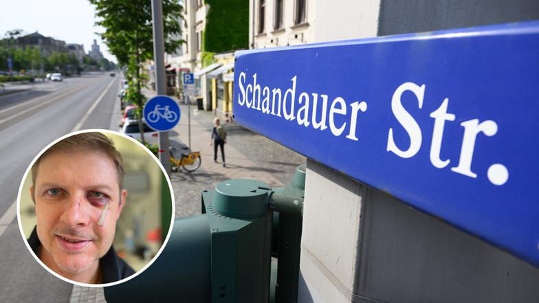 An der Schandauer Straße in Dresden ist SPD-Politiker Matthias Ecke am Freitagabend zusammengeschlagen worden.