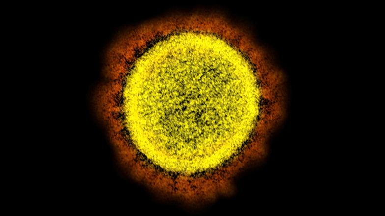 Die elektronenmikroskopische Aufnahme zeigt ein Coronavirus