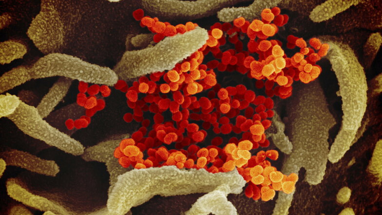 Das Coronavirus unter einem Rasterelektronenmikroskop.