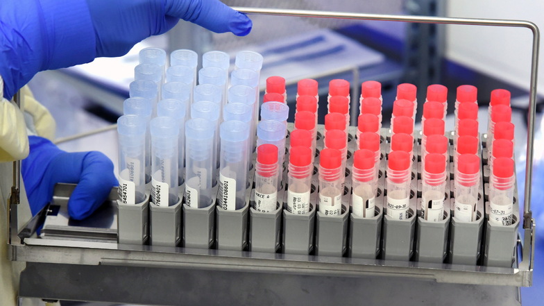 In einem Labor entnimmt eine Mitarbeiterin SARS-CoV-2-Proben aus einem PCR-Analysegerät. Wer sich derzeit mit dem Coronavirus infiziert, hat es in den meisten Fällen mit der Virusvariante B.1.1.7 zu tun.