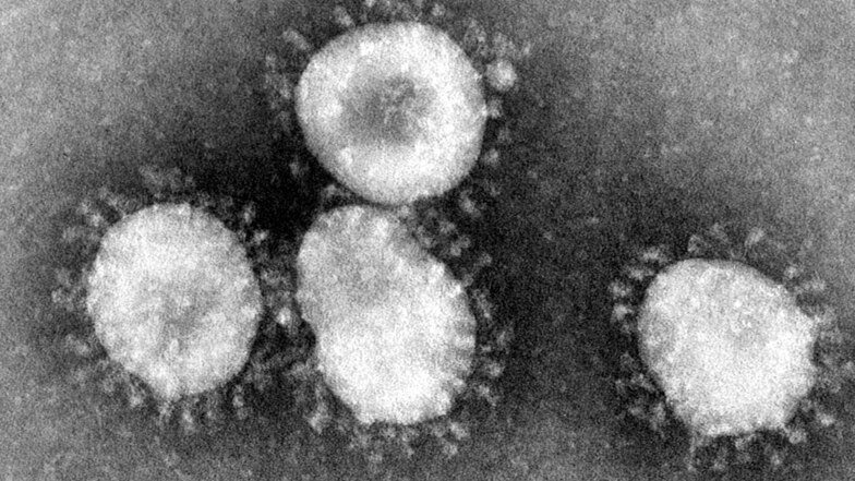 Dieses  Bild zeigt einen Coronavirus unter dem Mikroskop.
