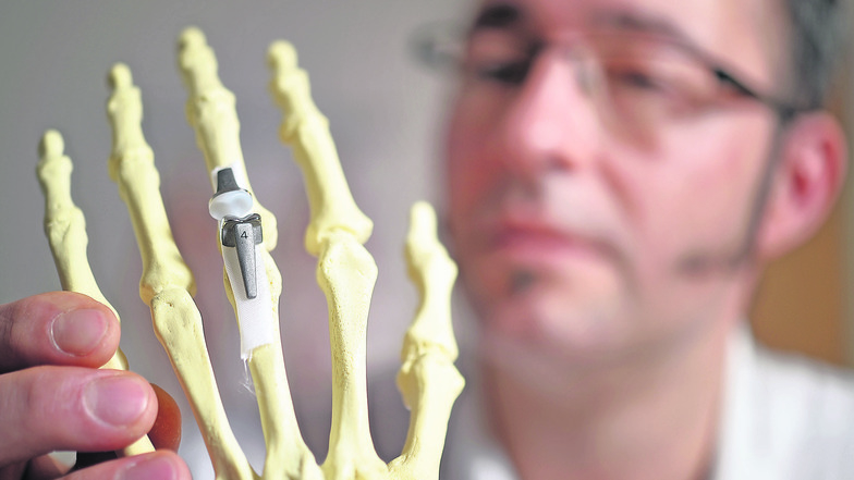 Handchirurg
Dr. Christian Otis Lorenz, Oberarzt der Klinik für Chirurgie II im Pirnaer Klinikum, zeigt an einem Handmodell, wie ein künstliches Gelenk für einen Finger aussieht. So etwas kommt bei Patienten zum Einsatz, die unter schmerzhaftem Gelenkversc