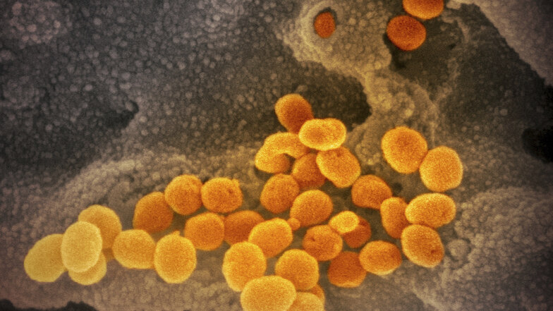 Eine elektronenmikroskopische Aufnahme zeigt das Coronavirus (Archivbild). In Südafrika ist eine neue Variante aufgetaucht.
