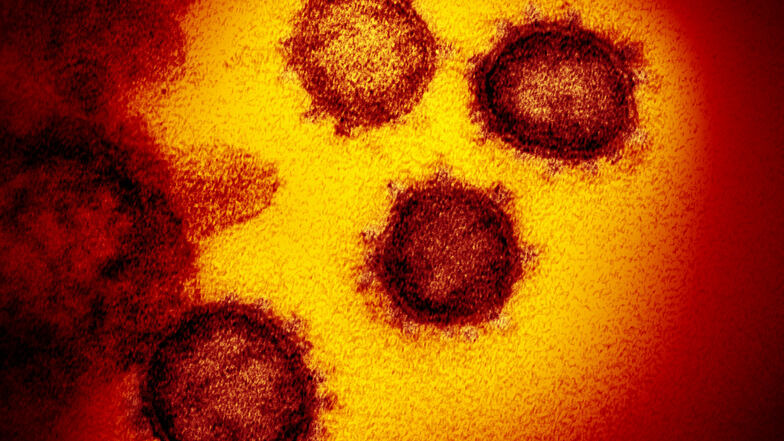 Das Coronavirus SARS-CoV-2 unter dem Elektronenmikroskopa.