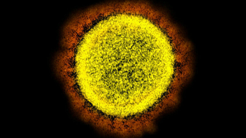Das Coronavirus unterm Elektronenmikroskop.
