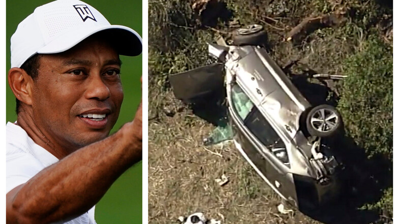 Tiger Woods wurde bei einem Autounfall schwer verletzt.