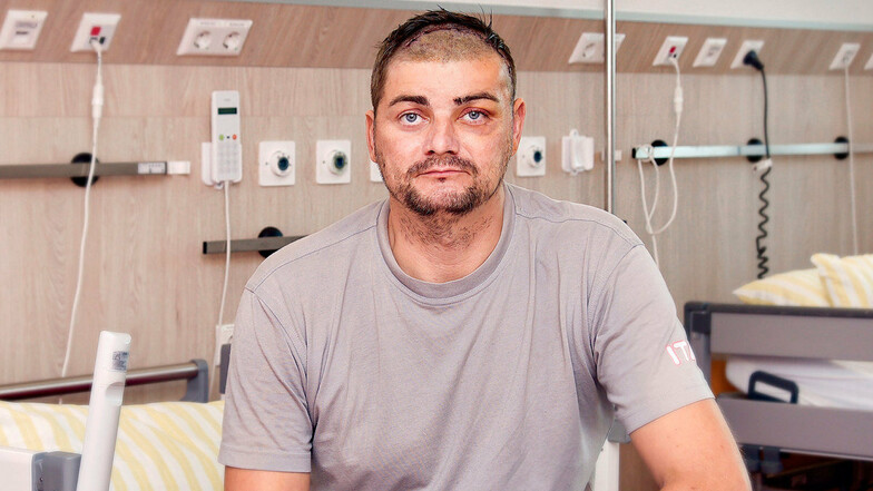 Carsten Kerneker am Tag zwei nach der OP. Der Tumor ist raus aus dem Kopf, dafür mussten teilweise die Haare ab.