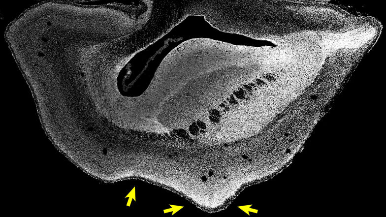 Die entscheidende menschliche Genveränderung wurde in Eizellen von Weißbüschelaffen eingeschleust. Diese mikroskopische Aufnahme stammt von einem 101 Tage alten Fötus. Pfeile zeigen auf Furchen und Gräben, wie sie sonst das menschliche Gehirn aufweist.