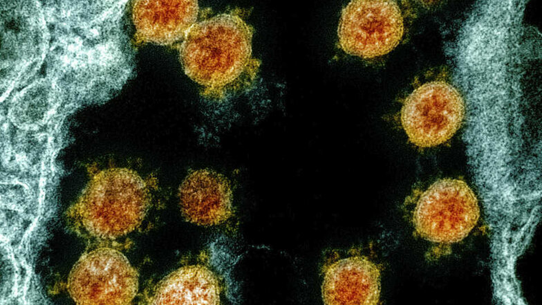 So sieht das Coronavirus unterm Elektronenmikroskop aus.