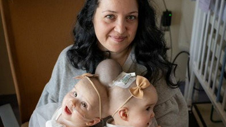 Mutter Liliya und Micaela und Abigail zwei Tage vor der Operation.