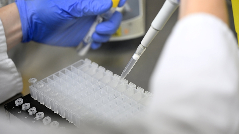 Eine Mitarbeiterin eines PCR-Testlabors bereitet PCR-Tests vor.