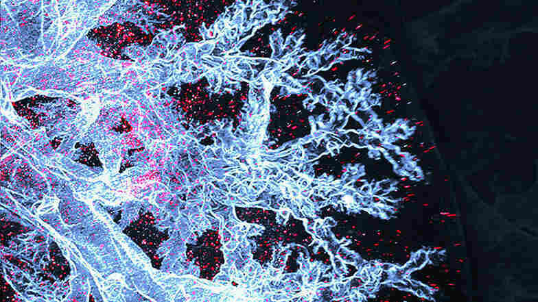 Makrophagen sind die Immunzellen. Einige leben in Lungenbläschen und schützen das Gewebe. Hier im Bild sind diese Immunzellen als rote Punkte in einer transparenten Mauslunge sichtbar gemacht.