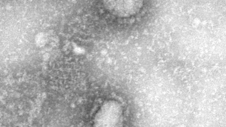 Das Bild zeigt den neuen Stamm des Coronavirus, der in der chinesischen Stadt Wuhan in der Provinz Hubei zahlreiche Menschen erkranken ließ.