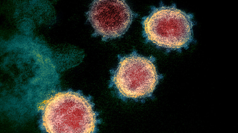 Eine mikroskopische Aufnahme von Coronaviren. An den Außenseiten leicht verschwommen zu erkennen, sind die sogenannten Spike-Proteine.