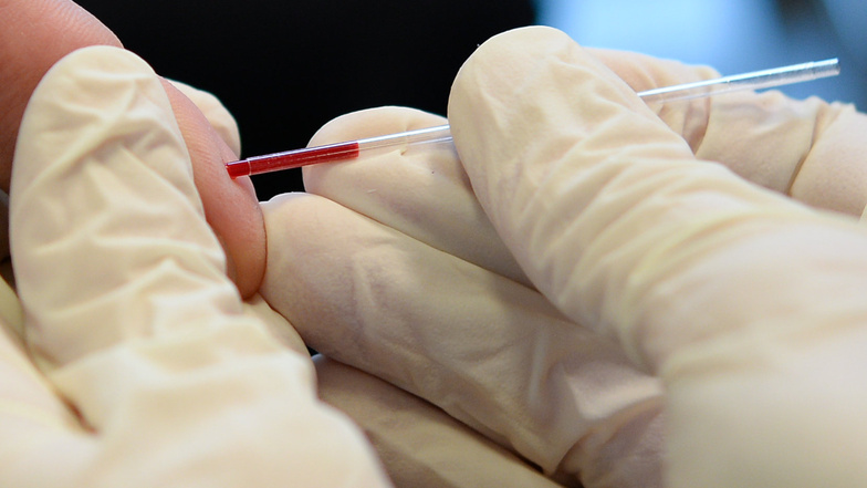 Ein Arzt nimmt bei der Aids-Hilfe e.v. an dem Finger eines jungen Mannes Blut ab.