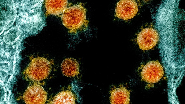 Diese vom "National Institute of Allergy and Infectious Diseases Integrated Research Facility" zur Verfügung gestellte elektronenmikroskopische Aufnahme zeigt Partikel des Coronavirus in orange