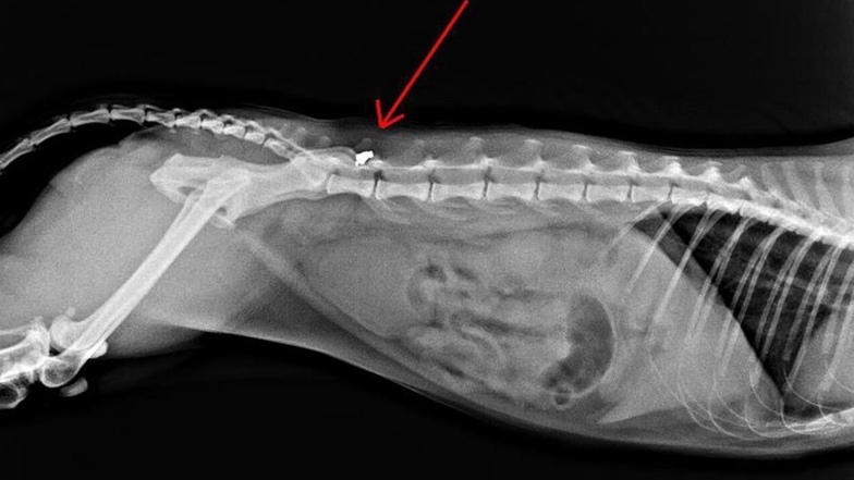 Wie auf dem Röntgenbild gut zu sehen ist, steckt das Geschoss im Übergangsbereich des letzten Lendenwirbels. Eine Operation, es zu entfernen, wollen Dörfels wegen einer möglichen Lähmung nicht.