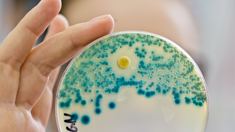 Indikatorkulturplatte zum Nachweis von resistenten Bakterien. Für deren Behandlung müssten neue Antibiotika entwickelt werden.