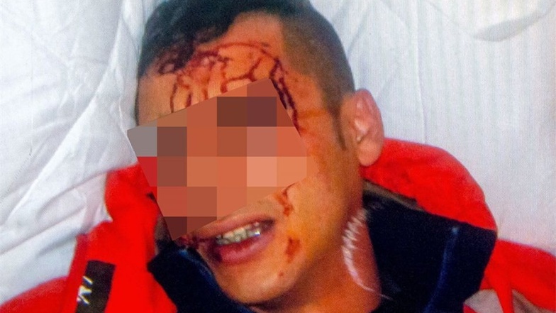 Der verletzte Flüchtling wurde von seinen Freunden vom Tatort abgeholt. Sie schossen daraufhin ein Foto von dem Verletzten.