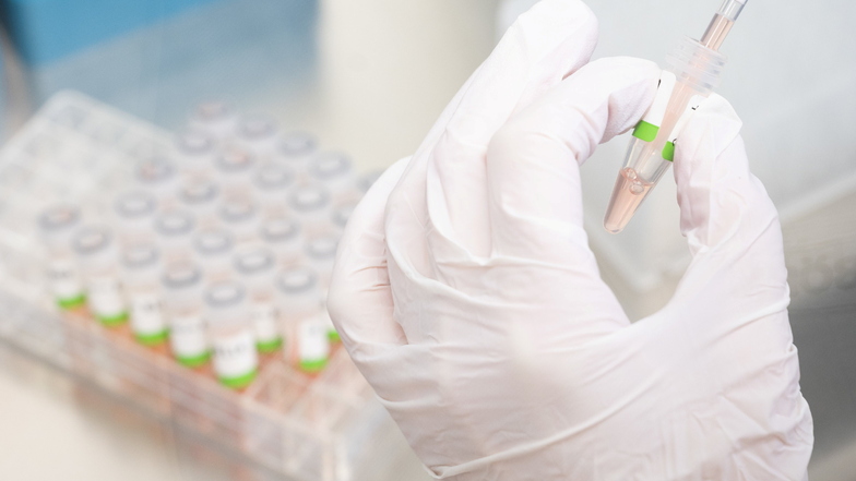 Eine biologisch-technische Assistentin bereitet in einem Labor PCR-Tests für die Analyse vor.