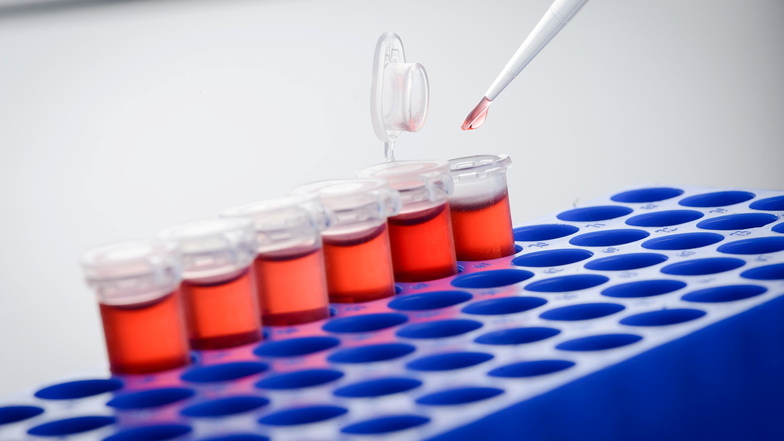 Dresdner Biotechfirma produziert Tests zur Krebs-Früherkennung