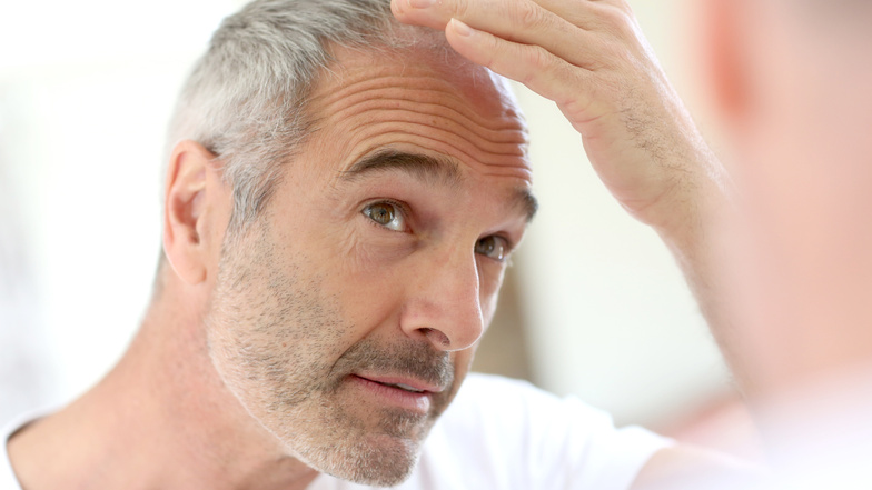 Auch wenn in vielen Fällen der Haarausfall vorbestimmt ist, lässt er sich verlangsamen.
