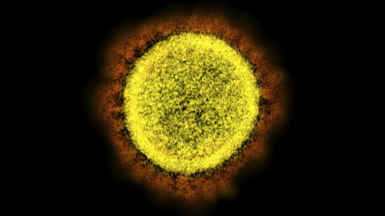 Eine elektronenmikroskopische Aufnahme zeigt das neuartige Coronavirus SARS-CoV-2.