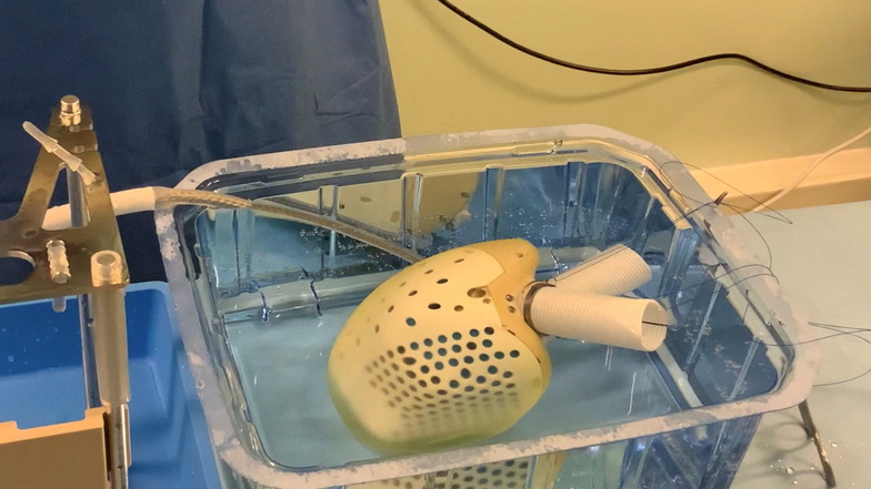 Blick in die Plastikbox: Das Kunstherz ist fertig aufbereitet für die Implantation. Das Kabel für die Stromversorgung wird durch den Brustkorb nach außen geleitet.
