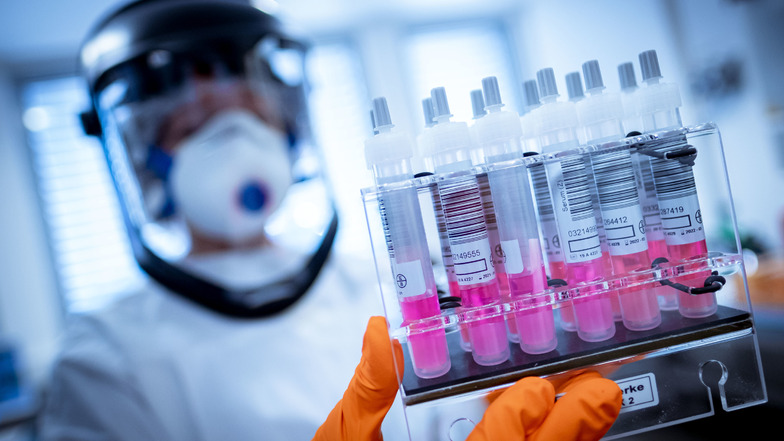 Eine wissenschaftliche Mitarbeiterin hält Coronavirus-Testproben im Niedersächsischen Landesamt für Verbraucherschutz und Lebensmittelsicherheit (LAVES) in der Hand.
