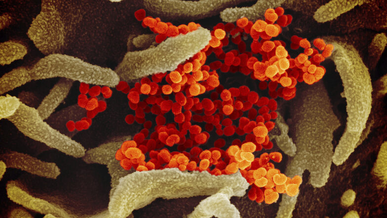 Diese elektronenmikroskopische Aufnahme des «U.S. National Institute of Health» zeigt das neuartige Coronavirus (SARS-CoV-2) (orange), das aus der Oberfläche von im Labor kultivierten Zellen (grau) austritt. Die Probe wurde von einem Patienten in den USA