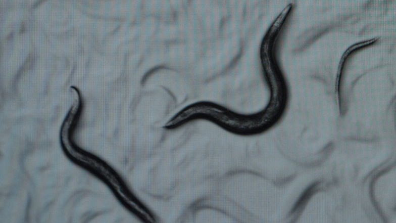 Fadenwürmer der Art C. elegans unter dem Mikroskop.
