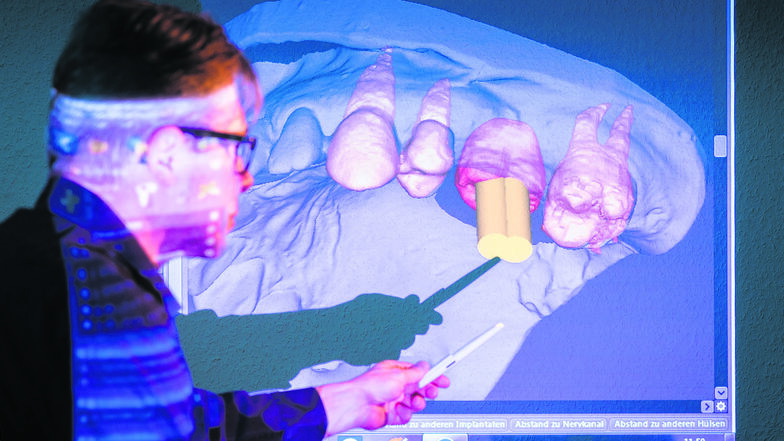 Zahntechniker Michael Menzel aus Görlitz erklärt sein patentiertes individuelles Implantatsystem. Rot der künftige prothetische Zahn, der am Computer dreidimensional geplant wird. Die gelbe Achse zeigt genau, in welcher Position später das Implantat mitte