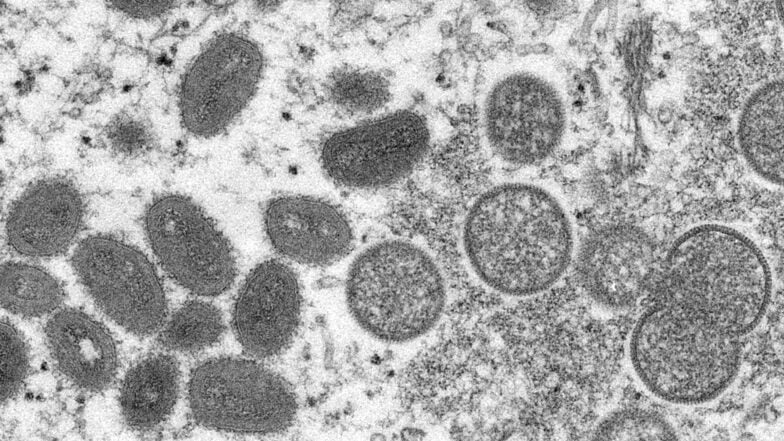 Diese elektronenmikroskopische Aufnahme zeigt reife, ovale Affenpockenviren (l.) und kugelförmige unreife Virionen.
