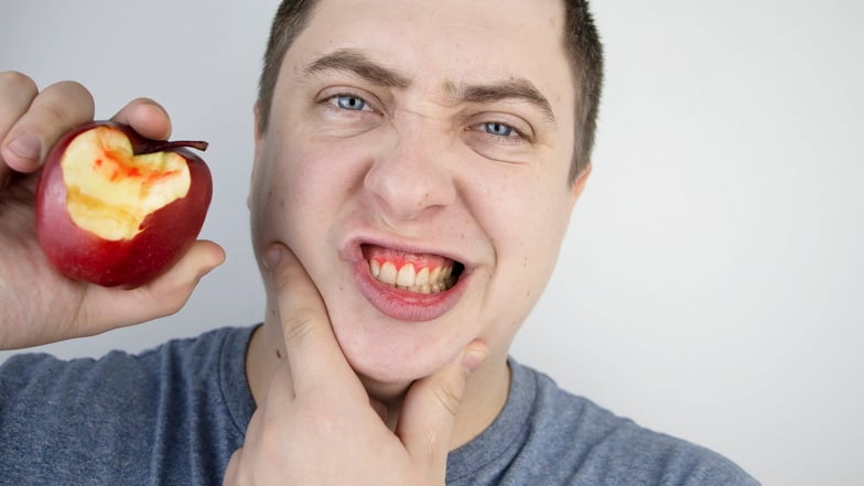 Alarmzeichen rot: Das Zahnfleisch blutet beim Biss in den Apfel.