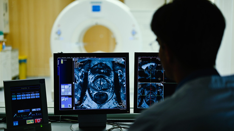 Ein Mitarbeiter betrachtet in einem Kontrollraum des Deutschen Krebsforschungszentrumauf einem Monitor das Querschnittsbild einer Prostata.