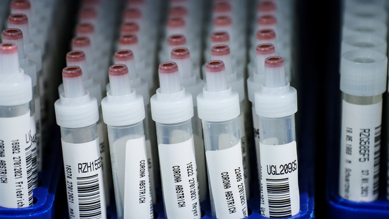 Kunststoffröhrchen mit Corona-Abstrichen stehen nach dem PCR-Test in einem Labor.