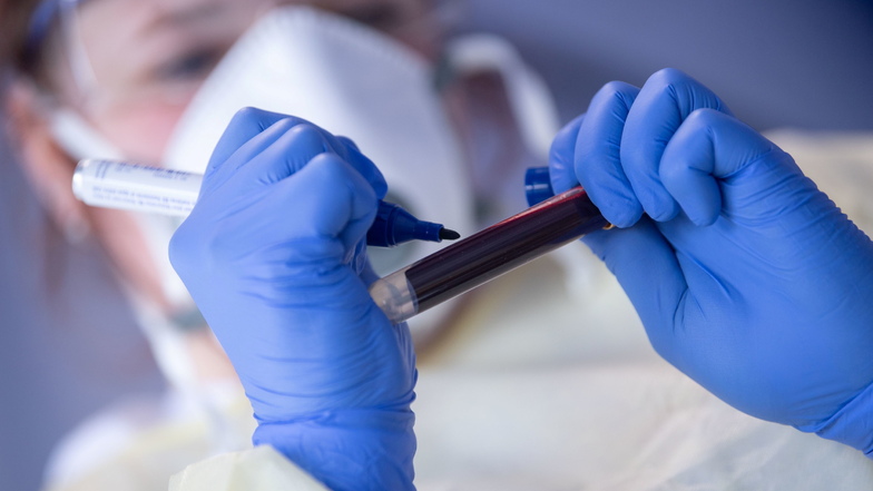 Eine Mitarbeiterin des Robert-Koch-Instituts beschriftet eine Blutprobe für einen Antikörpertest. Die Blutgruppe hat einen gewissen Einfluss auf das individuelle Corona-Infektionsrisiko. Die Inzidenz im Landkreis Meißen geht leicht zurück.