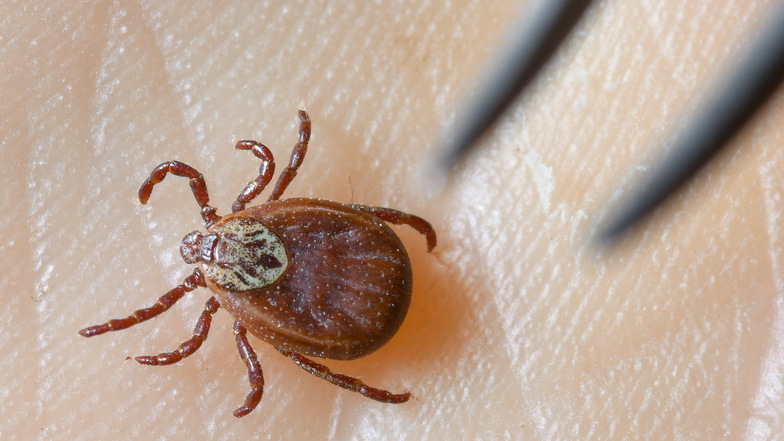 Zecken können Krankheiten wie Borreliose oder FSME übertragen. Bei manchen Patienten herrscht nach einem Stich Unsicherheit, sodass sie zur Sicherheit eine Klinik aufsuchen.