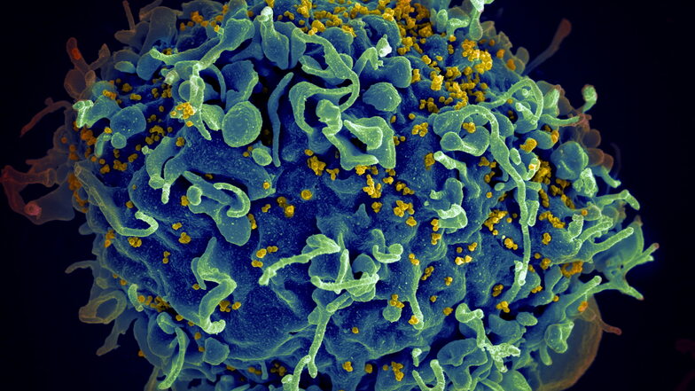 Das HI-Virus, hier gelb zu sehen, befällt Zellen des Immunsystems, die wichtig für die Abwehr von Krankheiten sind. Dort vermehrt es sich – spezielle Moleküle können genau das verhindern.