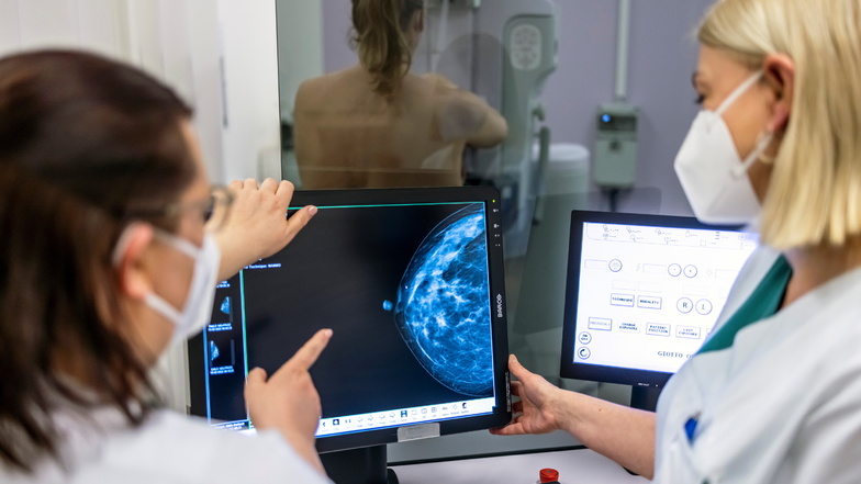 Künstliche Intelligenz bei der Mammografie findet bei mehr Frauen Brustkrebs