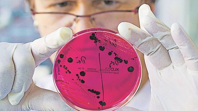 Eindeutiger Beweis: In einem Labor werden Lebensmittelproben untersucht. Die schwarzen Punkte zeigen an: Diese Probe ist mit Salmonellen belastet. Foto: dpa