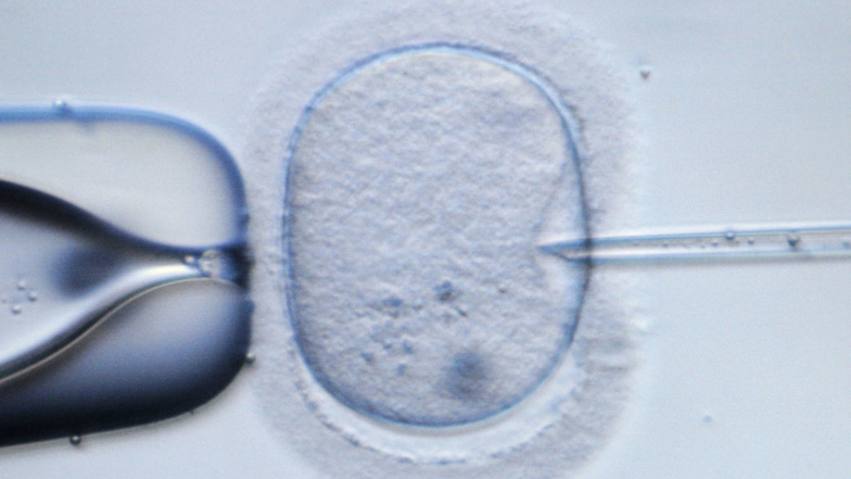 Zum Beispiel mittels einer Befruchtung von Eizellen im Labor können Frauen auch noch schwanger werden, wenn ihre Fruchtbarkeit durch eine Krebstherapie beeinträchtigt wurde. Voraussetzung ist allerdings, dass schon vor der Therapie entsprechende Maßnahmen