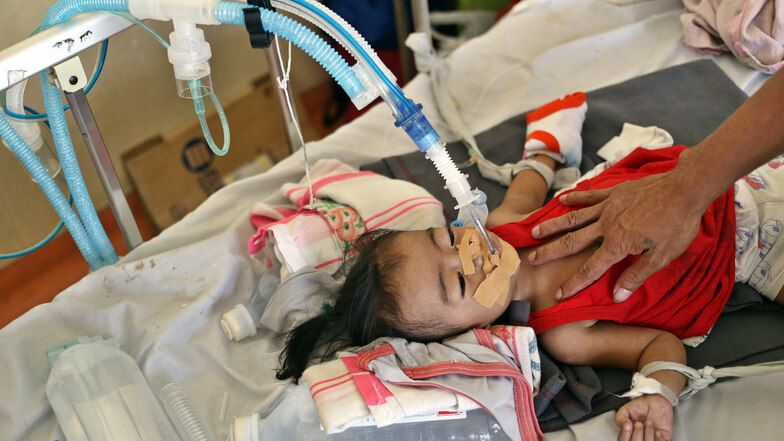 Philippinen, Manila: Ein Kind, das an Masern erkrankt ist, wird in einem Krankenhaus behandelt.