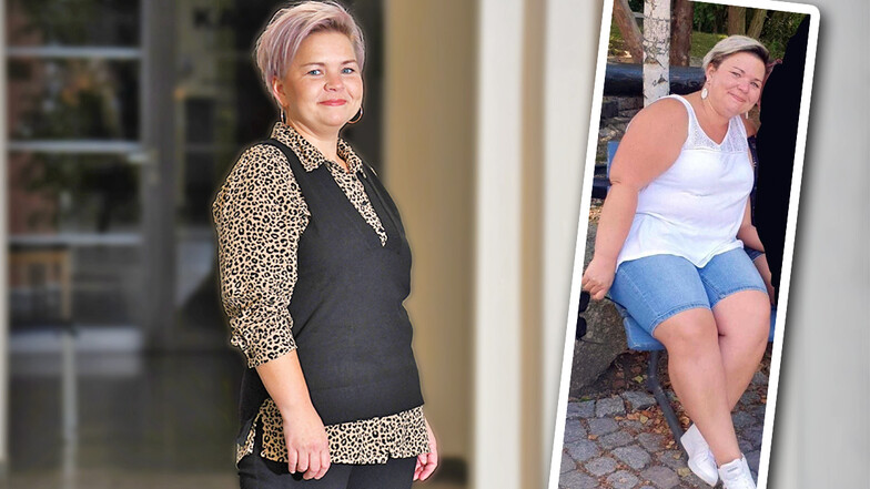 Anne Ladisch wog 107 Kilogramm, als sie sich einer Magenbypass-Operation unterzog. Kein leichter Schritt, sagt die Dresdnerin.