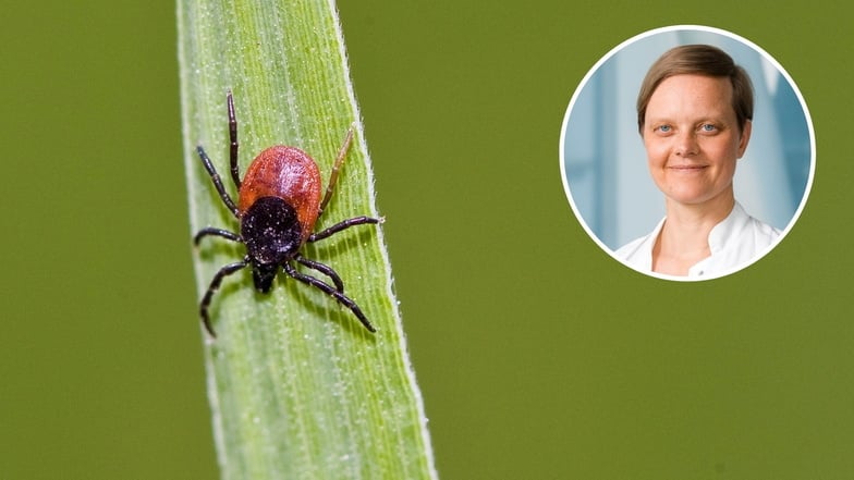 Zecken können FSME und Borreliose übertragen. Auch am Elblandklinikum in Meißen gibt es jedes Jahr Fälle, sagt Neurologin Dr. Helen Hanso.