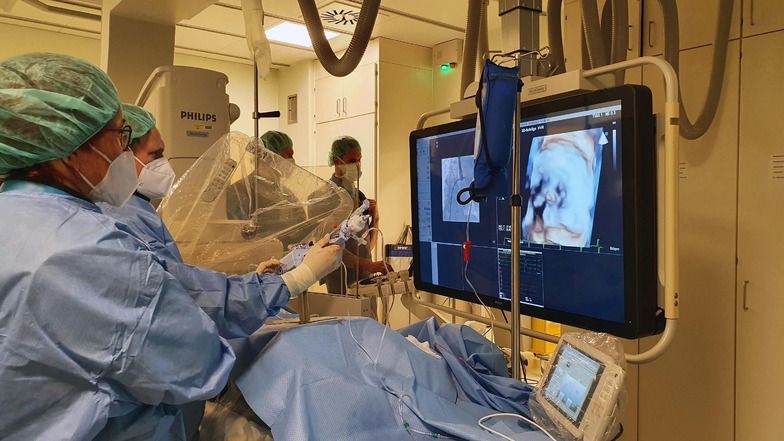 Während des Eingriffs: Mithilfe von Ultraschall und Röntgenbildern setzen die Kardiologen die Mitraclips ein und schließen mit ihnen die Segel der Mitralklappe.