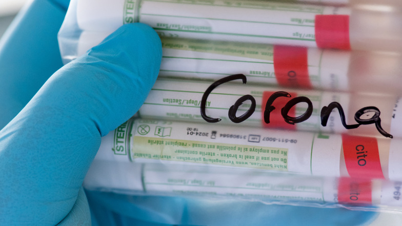 Die Kliniken im Landkreis Meißen verzeichnen einen weiteren Rückgang der Covid-19-Infektionen.