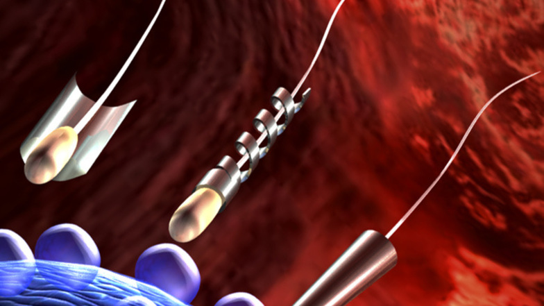 Spermien als Transportmittel. Die Visualisierung zeigt die drei Methoden: durch ein chemisches Trägermaterial (l.), durch die Drehbewegung einer Helix aus Metall (Mitte) und durch einen Biohybriden in Röhrchenform, der aus superdünnem Metall besteht. 